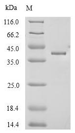 (Tris-Glycine gel) Discontinuous SDS-PAGE (reduced) with 5% enrichment gel and 15% separation gel. (Tris-Glycine gel) Discontinuous SDS-PAGE (reduced) with 5% enrichment gel and 15% separation gel.