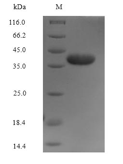 (Tris-Glycine gel) Discontinuous SDS-PAGE (reduced) with 5% enrichment gel and 15% separation gel. (Tris-Glycine gel) Discontinuous SDS-PAGE (reduced) with 5% enrichment gel and 15% separation gel.