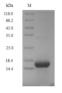 (Tris-Glycine gel) Discontinuous SDS-PAGE (reduced) with 5% enrichment gel and 15% separation gel. (Tris-Glycine gel) Discontinuous SDS-PAGE (reduced) with 5% enrichment gel and 15% separation gel.