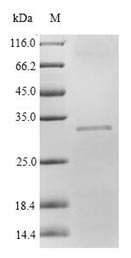 SDS-PAGE- Recombinant protein Rat Cfd