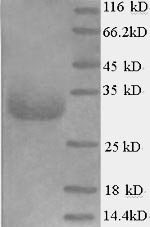 (Tris-Glycine gel) Discontinuous SDS-PAGE (reduced) with 5% enrichment gel and 15% separation gel.