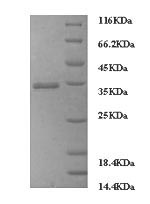 (Tris-Glycine gel) Discontinuous SDS-PAGE (reduced) with 5% enrichment gel and 15% separation gel. (Tris-Glycine gel) Discontinuous SDS-PAGE (reduced) with 5% enrichment gel and 15% separation gel.