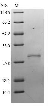 (Tris-Glycine gel) Discontinuous SDS-PAGE (reduced) with 5% enrichment gel and 15% separation gel. (Tris-Glycine gel) Discontinuous SDS-PAGE (reduced) with 5% enrichment gel and 15% separation gel.