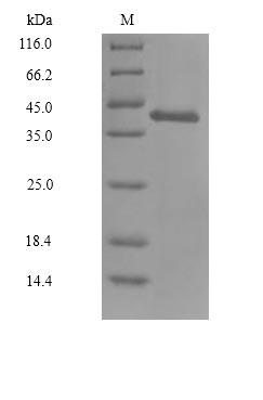 (Tris-Glycine gel) Discontinuous SDS-PAGE (reduced) with 5% enrichment gel and 15% separation gel. (Tris-Glycine gel) Discontinuous SDS-PAGE (reduced) with 5% enrichment gel and 15% separation gel.