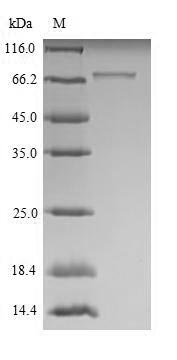(Tris-Glycine gel) Discontinuous SDS-PAGE (reduced) with 5% enrichment gel and 15% separation gel. (Tris-Glycine gel) Discontinuous SDS-PAGE (reduced) with 5% enrichment gel and 15% separation gel.
