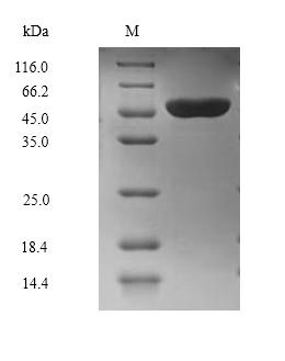 (Tris-Glycine gel) Discontinuous SDS-PAGE (reduced) with 5% enrichment gel and 15% separation gel. (Tris-Glycine gel) Discontinuous SDS-PAGE (reduced) with 5% enrichment gel and 15% separation gel.