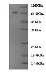 (Tris-Glycine gel) Discontinuous SDS-PAGE (reduced) with 5% enrichment gel and 15% separation gel. (Tris-Glycine gel) Discontinuous SDS-PAGE (reduced) with 5% enrichment gel and 15% separation gel.
