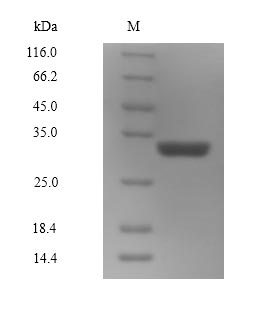 (Tris-Glycine gel) Discontinuous SDS-PAGE (reduced) with 5% enrichment gel and 15% separation gel.