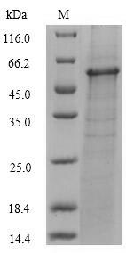 (Tris-Glycine gel) Discontinuous SDS-PAGE (reduced) with 5% enrichment gel and 15% separation gel. (Tris-Glycine gel) Discontinuous SDS-PAGE (reduced) with 5% enrichment gel and 15% separation gel.
