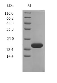 (Tris-Glycine gel) Discontinuous SDS-PAGE (reduced) with 5% enrichment gel and 15% separation gel. (Tris-Glycine gel) Discontinuous SDS-PAGE (reduced) with 5% enrichment gel and 15% separation gel.