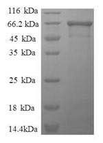 (Tris-Glycine gel) Discontinuous SDS-PAGE (reduced) with 5% enrichment gel and 15% separation gel. (Tris-Glycine gel) Discontinuous SDS-PAGE (reduced) with 5% enrichment gel and 15% separation gel.