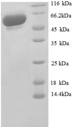 (Tris-Glycine gel) Discontinuous SDS-PAGE (reduced) with 5% enrichment gel and 15% separation gel.
