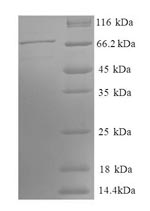 SDS-PAGE- Recombinant protein Human PGK1