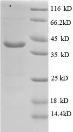 Recombinant Human V-type proton ATPase subunit G 1 (ATP6V1G1) - image 1