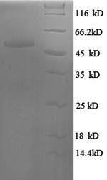 Recombinant Human Serine/arginine-rich splicing factor 9 (SRSF9) - image 1