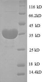 (Tris-Glycine gel) Discontinuous SDS-PAGE (reduced) with 5% enrichment gel and 15% separation gel. (Tris-Glycine gel) Discontinuous SDS-PAGE (reduced) with 5% enrichment gel and 15% separation gel.