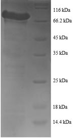 (Tris-Glycine gel) Discontinuous SDS-PAGE (reduced) with 5% enrichment gel and 15% separation gel. (Tris-Glycine gel) Discontinuous SDS-PAGE (reduced) with 5% enrichment gel and 15% separation gel.
