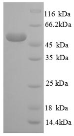 (Tris-Glycine gel) Discontinuous SDS-PAGE (reduced) with 5% enrichment gel and 15% separation gel. (Tris-Glycine gel) Discontinuous SDS-PAGE (reduced) with 5% enrichment gel and 15% separation gel.