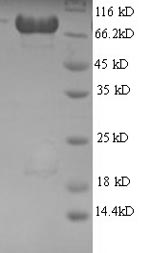 (Tris-Glycine gel) Discontinuous SDS-PAGE (reduced) with 5% enrichment gel and 15% separation gel. (Tris-Glycine gel) Discontinuous SDS-PAGE (reduced) with 5% enrichment gel and 15% separation gel.