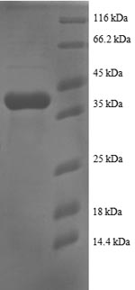 (Tris-Glycine gel) Discontinuous SDS-PAGE (reduced) with 5% enrichment gel and 15% separation gel. (Tris-Glycine gel) Discontinuous SDS-PAGE (reduced) with 5% enrichment gel and 15% separation gel.