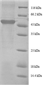 (Tris-Glycine gel) Discontinuous SDS-PAGE (reduced) with 5% enrichment gel and 15% separation gel. (Tris-Glycine gel) Discontinuous SDS-PAGE (reduced) with 5% enrichment gel and 15% separation gel.