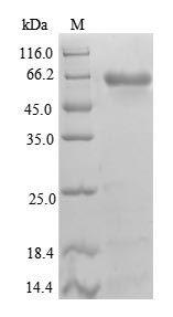 (Tris-Glycine gel) Discontinuous SDS-PAGE (reduced) with 5% enrichment gel and 15% separation gel. (Tris-Glycine gel) Discontinuous SDS-PAGE (reduced) with 5% enrichment gel and 15% separation gel.