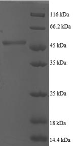 (Tris-Glycine gel) Discontinuous SDS-PAGE (reduced) with 5% enrichment gel and 15% separation gel. (Tris-Glycine gel) Discontinuous SDS-PAGE (reduced) with 5% enrichment gel and 15% separation gel.