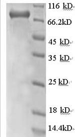 Recombinant Human Rab GDP dissociation inhibitor beta (GDI2) , partial - image 1