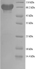 (Tris-Glycine gel) Discontinuous SDS-PAGE (reduced) with 5% enrichment gel and 15% separation gel. (Tris-Glycine gel) Discontinuous SDS-PAGE (reduced) with 5% enrichment gel and 15% separation gel.