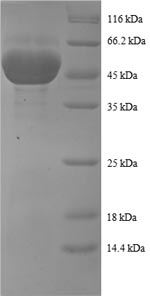 (Tris-Glycine gel) Discontinuous SDS-PAGE (reduced) with 5% enrichment gel and 15% separation gel. (Tris-Glycine gel) Discontinuous SDS-PAGE (reduced) with 5% enrichment gel and 15% separation gel.