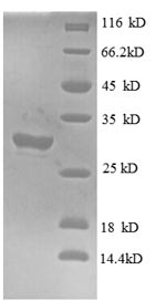 Recombinant Human Interferon-induced transmembrane protein 1 (IFITM1) , partial - image 1
