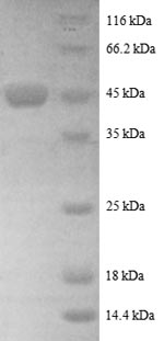 (Tris-Glycine gel) Discontinuous SDS-PAGE (reduced) with 5% enrichment gel and 15% separation gel. (Tris-Glycine gel) Discontinuous SDS-PAGE (reduced) with 5% enrichment gel and 15% separation gel.