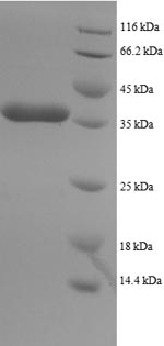 (Tris-Glycine gel) Discontinuous SDS-PAGE (reduced) with 5% enrichment gel and 15% separation gel. (Tris-Glycine gel) Discontinuous SDS-PAGE (reduced) with 5% enrichment gel and 15% separation gel.