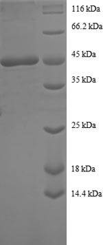(Tris-Glycine gel) Discontinuous SDS-PAGE (reduced) with 5% enrichment gel and 15% separation gel. (Tris-Glycine gel) Discontinuous SDS-PAGE (reduced) with 5% enrichment gel and 15% separation gel.