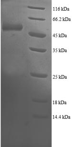 (Tris-Glycine gel) Discontinuous SDS-PAGE (reduced) with 5% enrichment gel and 15% separation gel. (Tris-Glycine gel) Discontinuous SDS-PAGE (reduced) with 5% enrichment gel and 15% separation gel.