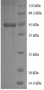 Recombinant Human Prefoldin subunit 5 (PFDN5) - image 1