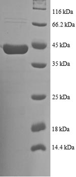 (Tris-Glycine gel) Discontinuous SDS-PAGE (reduced) with 5% enrichment gel and 15% separation gel. (Tris-Glycine gel) Discontinuous SDS-PAGE (reduced) with 5% enrichment gel and 15% separation gel.