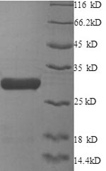 (Tris-Glycine gel) Discontinuous SDS-PAGE (reduced) with 5% enrichment gel and 15% separation gel. (Tris-Glycine gel) Discontinuous SDS-PAGE (reduced) with 5% enrichment gel and 15% separation gel.