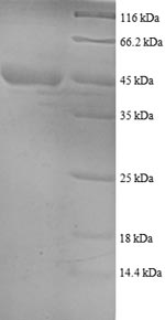 Recombinant Human 40S ribosomal protein S18 (RPS18) - image 1