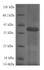 (Tris-Glycine gel) Discontinuous SDS-PAGE (reduced) with 5% enrichment gel and 15% separation gel. (Tris-Glycine gel) Discontinuous SDS-PAGE (reduced) with 5% enrichment gel and 15% separation gel.