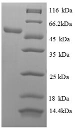 (Tris-Glycine gel) Discontinuous SDS-PAGE (reduced) with 5% enrichment gel and 15% separation gel. (Tris-Glycine gel) Discontinuous SDS-PAGE (reduced) with 5% enrichment gel and 15% separation gel.