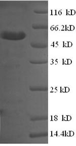 (Tris-Glycine gel) Discontinuous SDS-PAGE (reduced) with 5% enrichment gel and 15% separation gel. (Tris-Glycine gel) Discontinuous SDS-PAGE (reduced) with 5% enrichment gel and 15% separation gel.