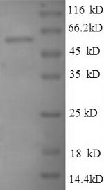 (Tris-Glycine gel) Discontinuous SDS-PAGE (reduced) with 5% enrichment gel and 15% separation gel.