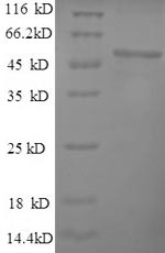(Tris-Glycine gel) Discontinuous SDS-PAGE (reduced) with 5% enrichment gel and 15% separation gel. (Tris-Glycine gel) Discontinuous SDS-PAGE (reduced) with 5% enrichment gel and 15% separation gel.