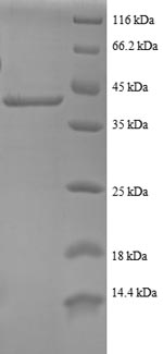 (Tris-Glycine gel) Discontinuous SDS-PAGE (reduced) with 5% enrichment gel and 15% separation gel. (Tris-Glycine gel) Discontinuous SDS-PAGE (reduced) with 5% enrichment gel and 15% separation gel.