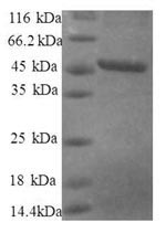 (Tris-Glycine gel) Discontinuous SDS-PAGE (reduced) with 5% enrichment gel and 15% separation gel. (Tris-Glycine gel) Discontinuous SDS-PAGE (reduced) with 5% enrichment gel and 15% separation gel.