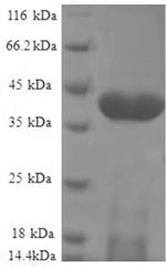 (Tris-Glycine gel) Discontinuous SDS-PAGE (reduced) with 5% enrichment gel and 15% separation gel. (Tris-Glycine gel) Discontinuous SDS-PAGE (reduced) with 5% enrichment gel and 15% separation gel.