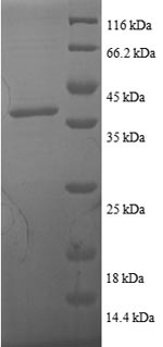 Recombinant Human Thioredoxin (TXN) - image 1