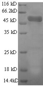 Recombinant Human Actin-related protein 2/3 complex subunit 2 (ARPC2) , partial - image 1