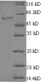(Tris-Glycine gel) Discontinuous SDS-PAGE (reduced) with 5% enrichment gel and 15% separation gel.